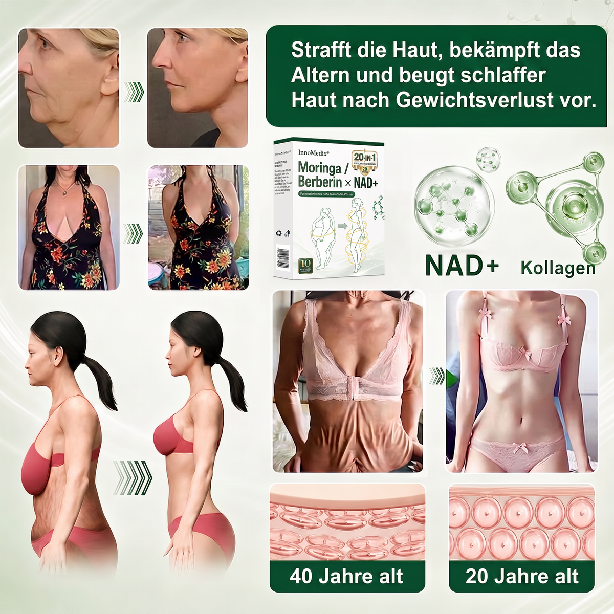 InnoMedix® Moringa Berberin x NAD+ 20-IN-1 Fortgeschrittenes Nano-Mikronadel-Pflaster (Nur einmal täglich anwenden – sichtbare Veränderungen in nur 7 Tagen.)