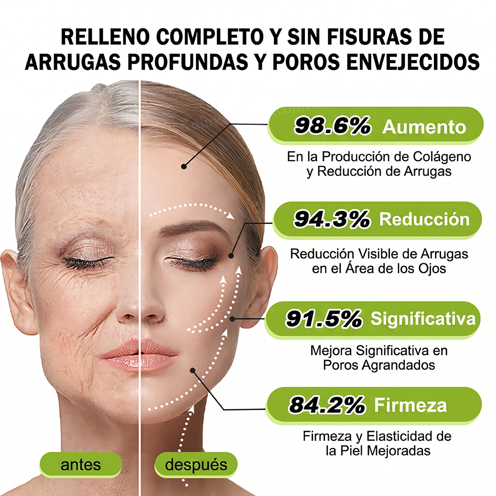 [⏰ ¡Último día! 40% de descuento] Rolimey® Botox & Vita-A Retinol Shot Crema Reafirmante y Lifting de Arrugas