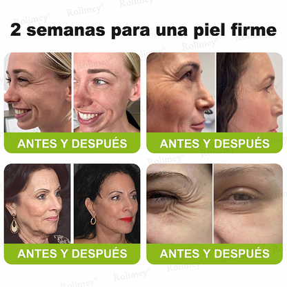 [⏰ ¡Último día! 40% de descuento] Rolimey® Botox & Vita-A Retinol Shot Crema Reafirmante y Lifting de Arrugas