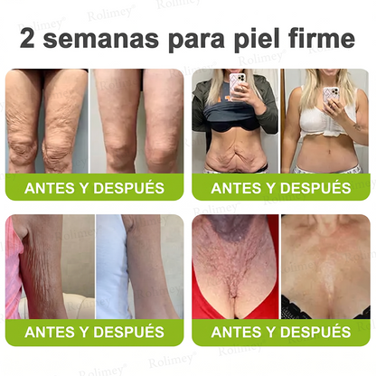 [⏰ ¡Último día! 40% de descuento] Rolimey® Botox & Vita-A Retinol Shot Crema Reafirmante y Lifting de Arrugas