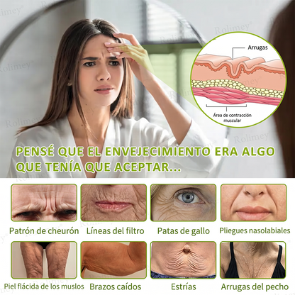 [⏰ ¡Último día! 40% de descuento] Rolimey® Botox & Vita-A Retinol Shot Crema Reafirmante y Lifting de Arrugas