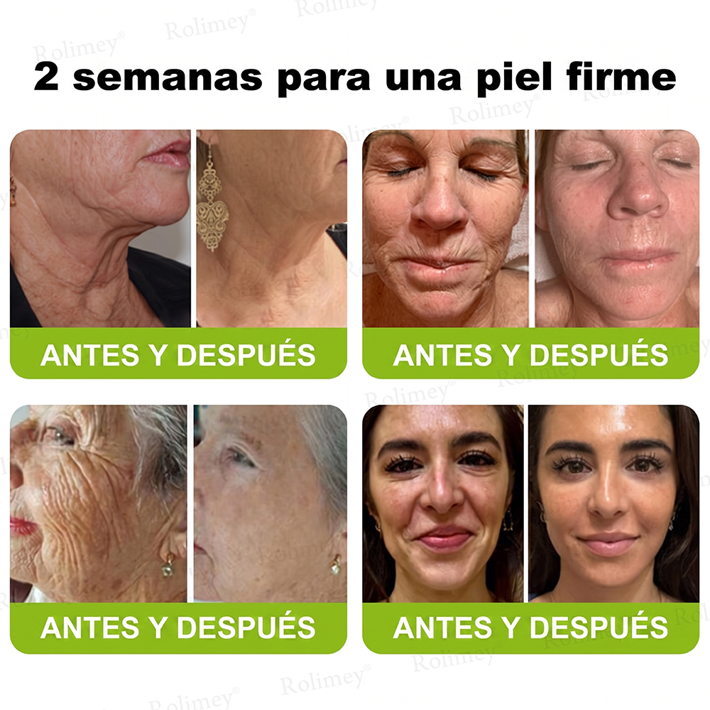 [⏰ ¡Último día! 40% de descuento] Rolimey® Botox & Vita-A Retinol Shot Crema Reafirmante y Lifting de Arrugas