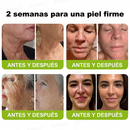 [⏰ ¡Último día! 40% de descuento] Rolimey® Botox & Vita-A Retinol Shot Crema Reafirmante y Lifting de Arrugas