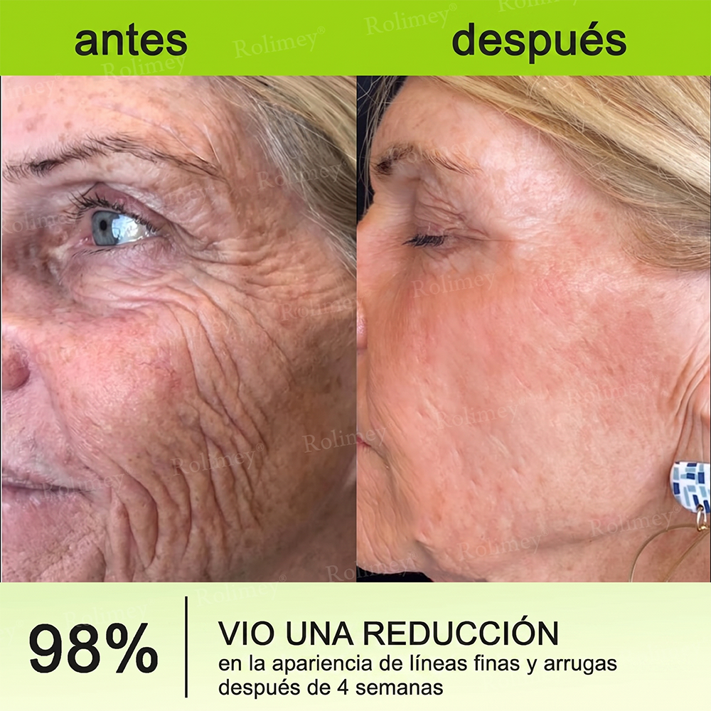 [⏰ ¡Último día! 40% de descuento] Rolimey® Botox & Vita-A Retinol Shot Crema Reafirmante y Lifting de Arrugas