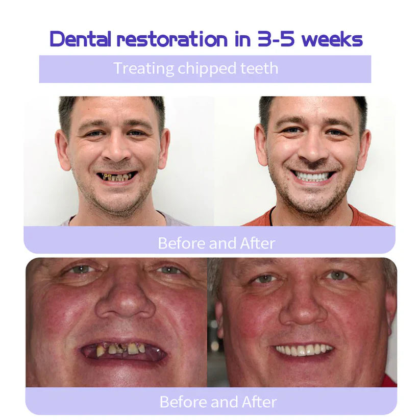🦷 Más Vendido (2 uds) - $680 MXN | ≈$340 MXN/ud