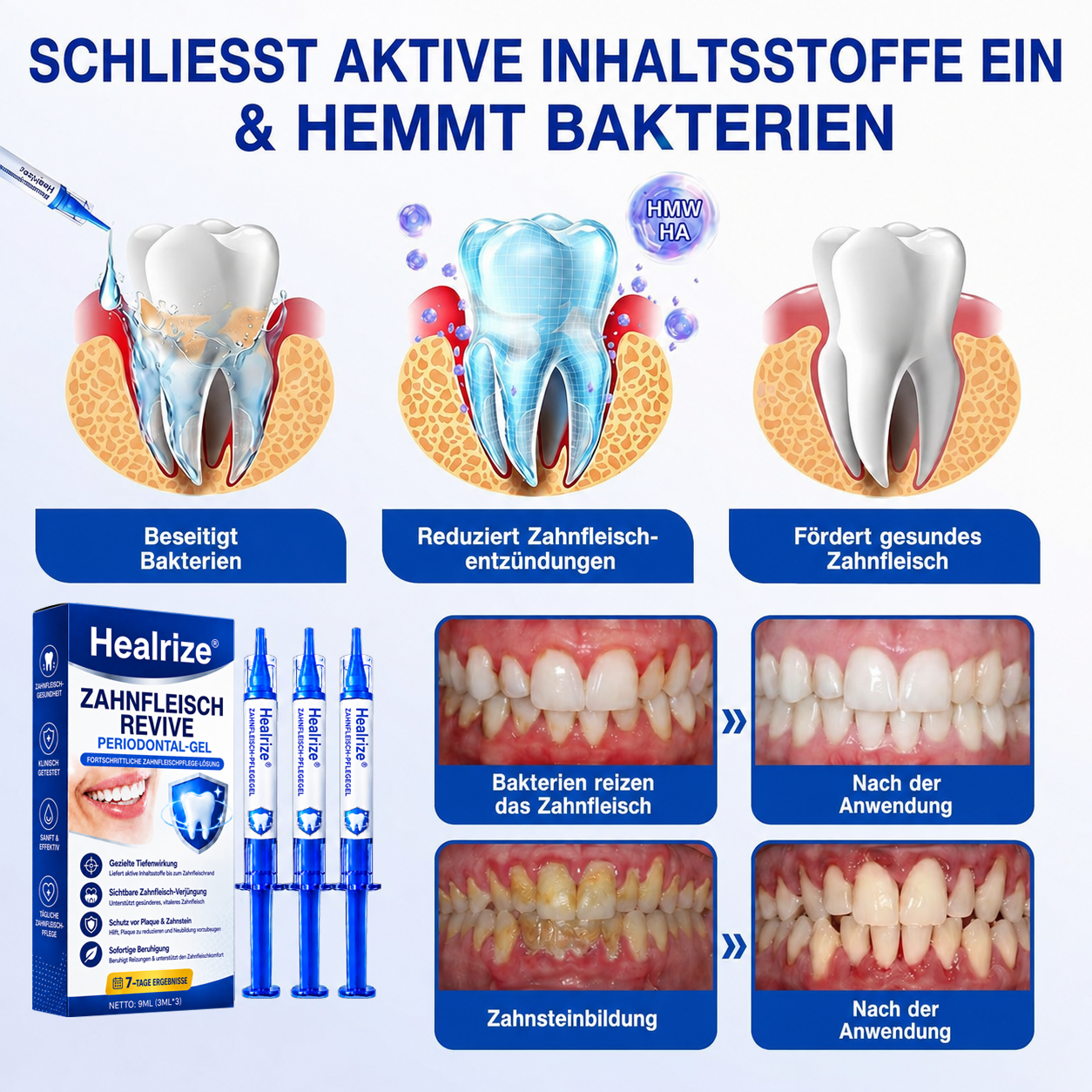 🦷🦢Healrize® GumRevive Gel